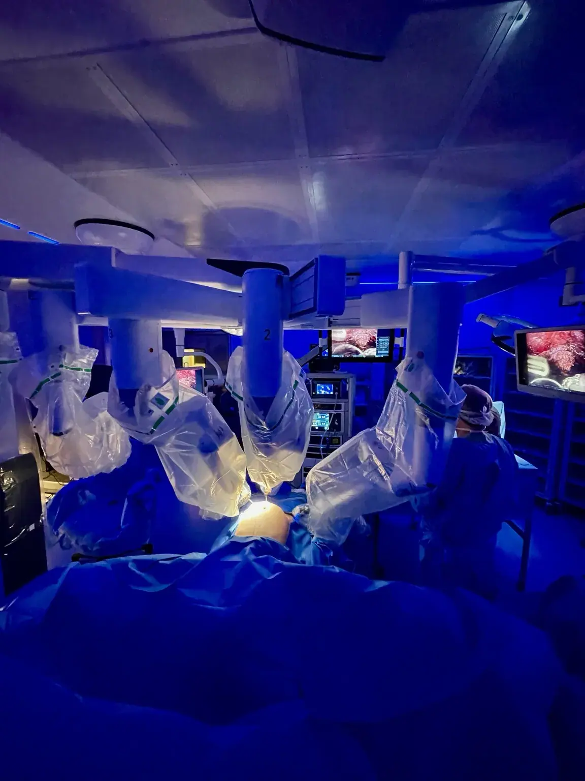 Centro cirúrgico preparado para procedimento com plataforma de cirurgia robótica